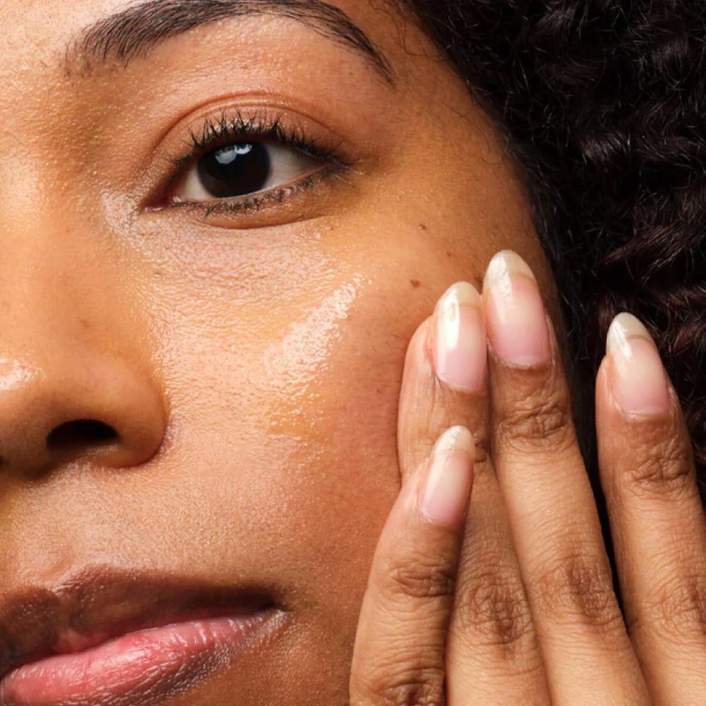 Niacinamide Blemish Removal Serum, 30 Ml